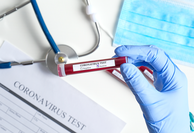 Le PTB dénonce le business des tests du coronavirus et interpelle la ministre De Block